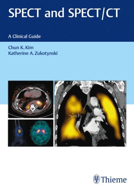 Katherine Zukotynski, Chun Kim - SPECT and SPECT/CT, E-bok. Tillgänglighet: Lägg i varukorg