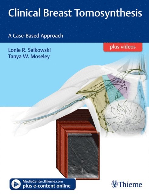 Tanya Moseley, Lonie R. Salkowski - Clinical Breast Tomosynthesis, E-bok
