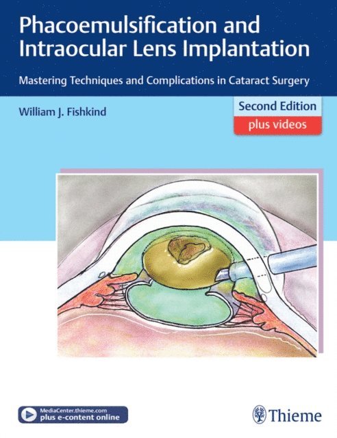 William J. Fishkind - Phacoemulsification and Intraocular Lens Implantation, E-bok