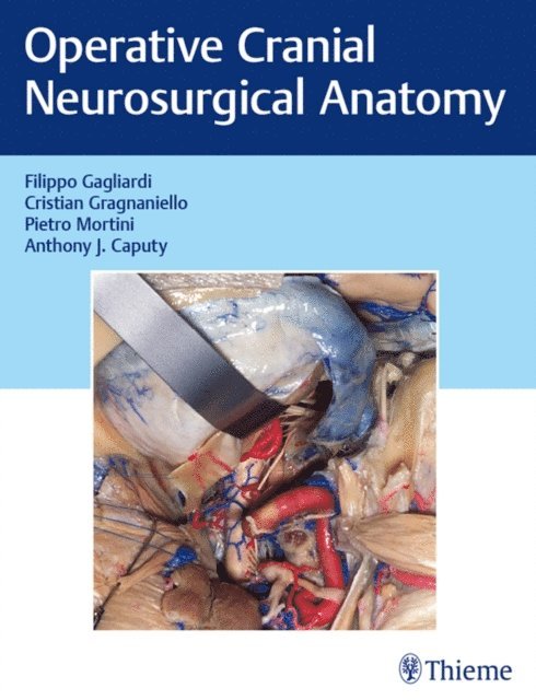 Anthony J. Caputy, Pietro Mortini, Cristian Gragnaniello, Filippo Gagliardi - Operative Cranial Neurosurgical Anatomy, E-bok