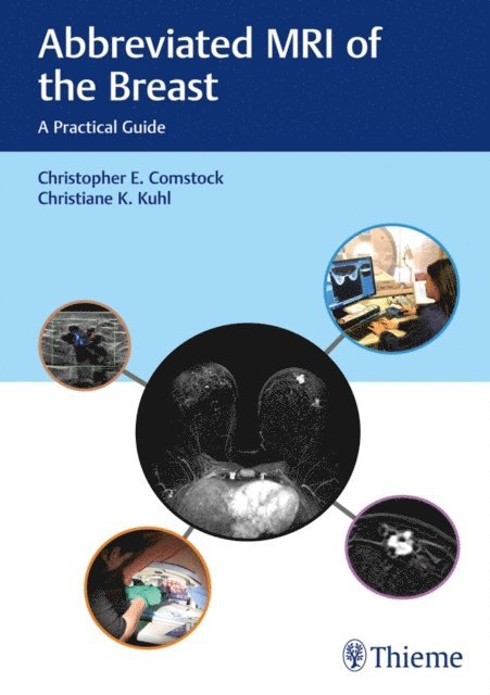 Christiane Kuhl, Christopher E. Comstock - Abbreviated MRI of the Breast, E-bok