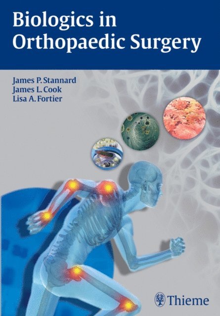 Lisa Fortier, James L. Cook, James P. Stannard - Biologics in Orthopaedic Surgery, E-bok