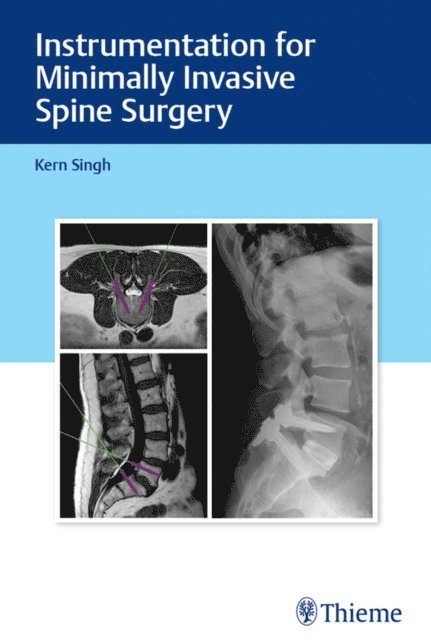 Kern Singh - Instrumentation for Minimally Invasive Spine Surgery, E-bok