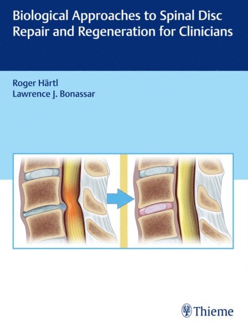 Larry Bonassar, Roger Hartl - Biological Approaches to Spinal Disc Repair and Regeneration for Clinicians, E-bok