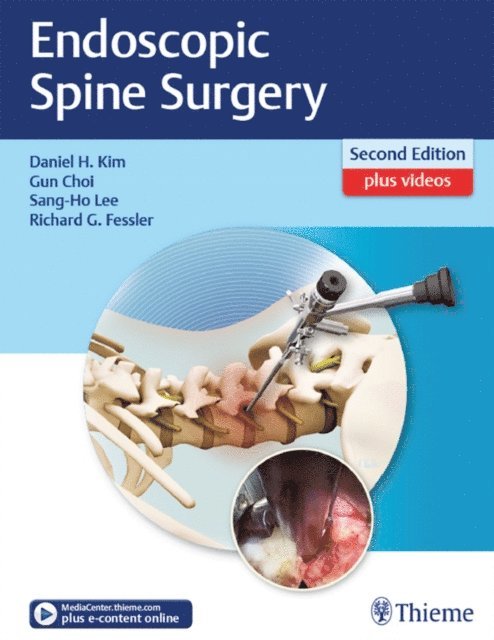 Richard Glenn Fessler, Sang-Ho Lee, Gun Choi, Daniel H. Kim - Endoscopic Spine Surgery, E-bok