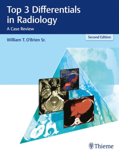 William T. O'Brien - Top 3 Differentials in Radiology, E-bok