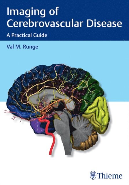 Val M. Runge - Imaging of Cerebrovascular Disease, E-bok