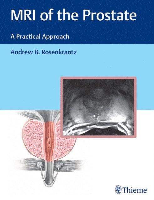 Andrew Rosenkrantz - MRI of the Prostate, E-bok