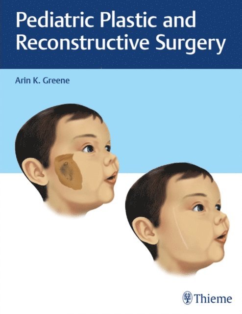 Arin K. Greene - Pediatric Plastic and Reconstructive Surgery, E-bok