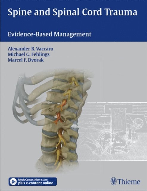Marcel F. Dvorak, Michael G. Fehlings, Alexander R. Vaccaro - Spine and Spinal Cord Trauma, E-bok