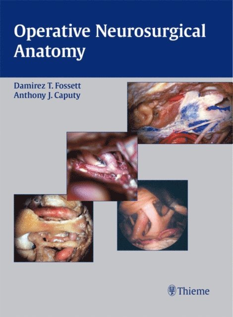 Anthony J. Caputy, Damirez T. Fossett - Operative Neurosurgical Anatomy, E-bok