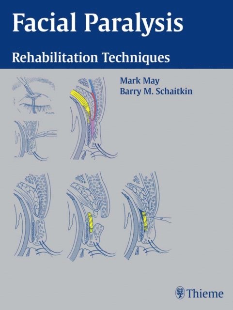 Barry M. Schaitkin, Mark May - Facial Paralysis, E-bok