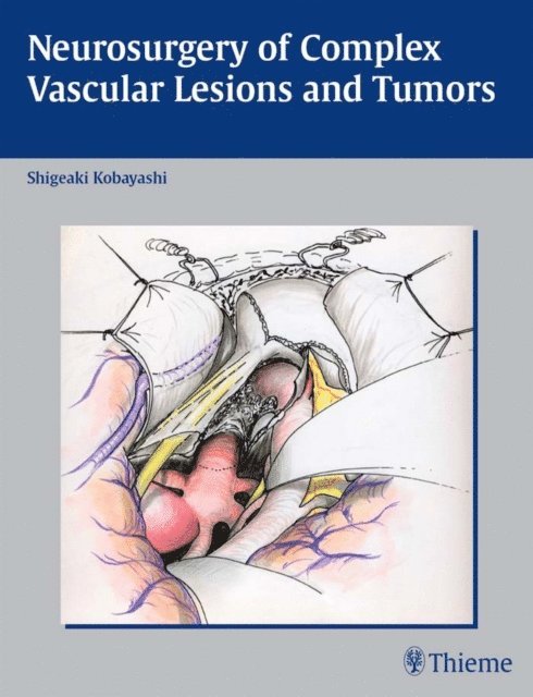 S. Kobayashi - Neurosurgery of Complex Vascular Lesions and Tumors, E-bok