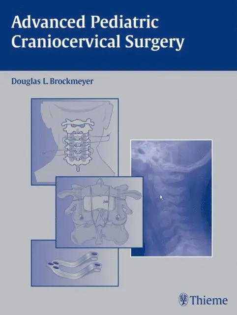 Douglas L. Brockmeyer - Advanced Pediatric Craniocervical Surgery, E-bok. Tillgänglighet: Lägg i varukorg