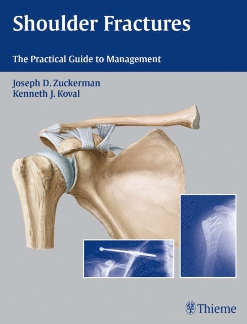 Kenneth Koval, Joseph D. Zuckerman - Shoulder Fractures, E-bok. Tillgänglighet: Lägg i varukorg