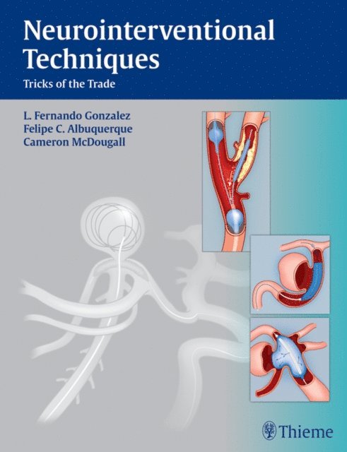 Cameron G. McDougall, Felipe C. Albuquerque, Fernando L. Gonzalez - Neurointerventional Techniques, E-bok