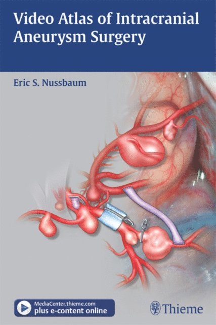 Eric Nussbaum - Video Atlas of Intracranial Aneurysm Surgery, E-bok