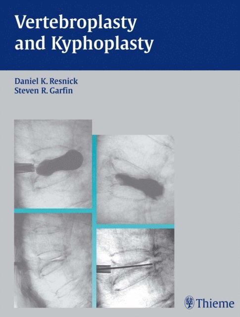 Steven R. Garfin, Daniel K. Resnick - Vertebroplasty and Kyphoplasty, E-bok