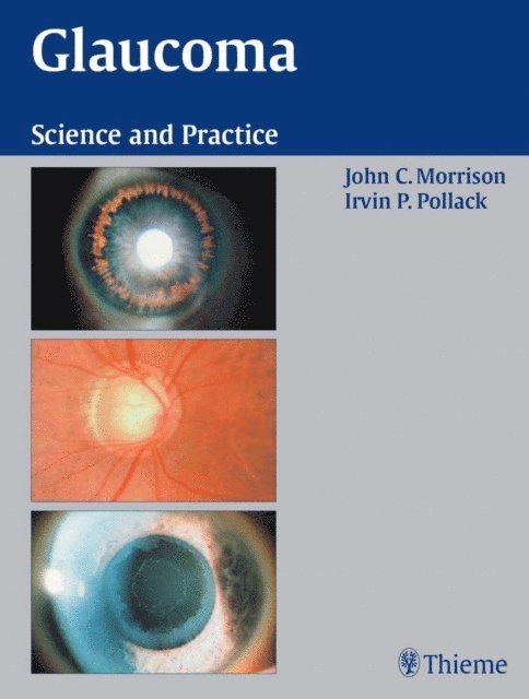 Irvin P. Pollack, John C. Morrison - Glaucoma, E-bok