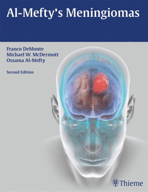 Ossama Al-Mefty, Michael W. McDermott, Franco DeMonte - Al-Mefty's Meningiomas, E-bok