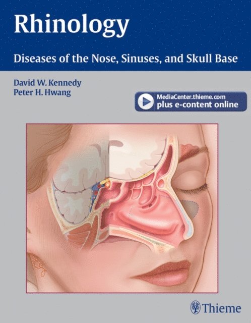 Peter H. Hwang, David W. Kennedy - Rhinology, E-bok