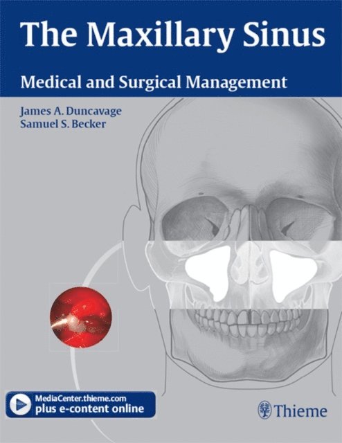 Samuel S. Becker, James A. Duncavage - Maxillary Sinus, E-bok