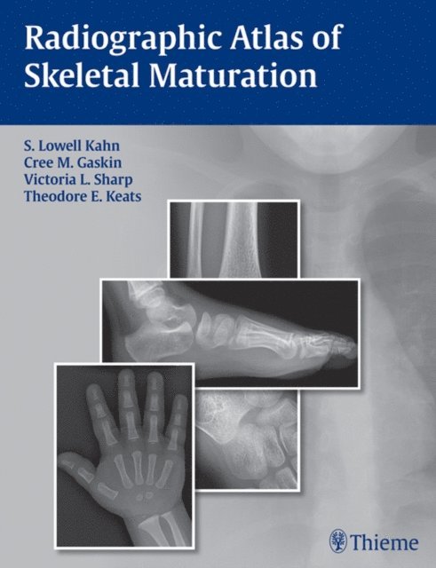 Bing Li, Theodore E. Keats, Victoria L. Sharp, Christopher M. Gaskin, S. Lowell Kahn - Radiographic Atlas of Skeletal Maturation, E-bok