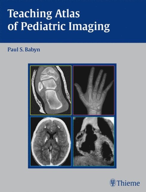 Paul Babyn - Teaching Atlas of Pediatric Imaging, E-bok