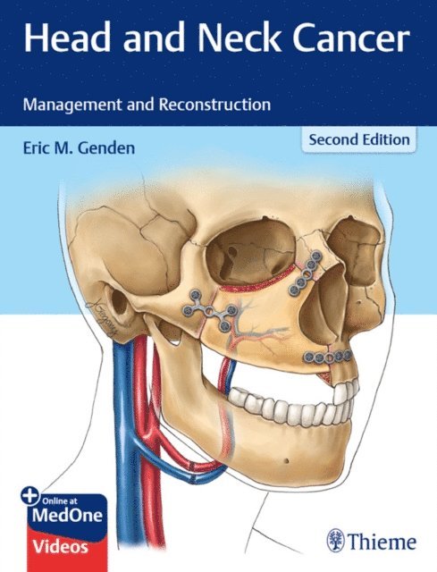 Eric M. Genden - Head and Neck Cancer, E-bok