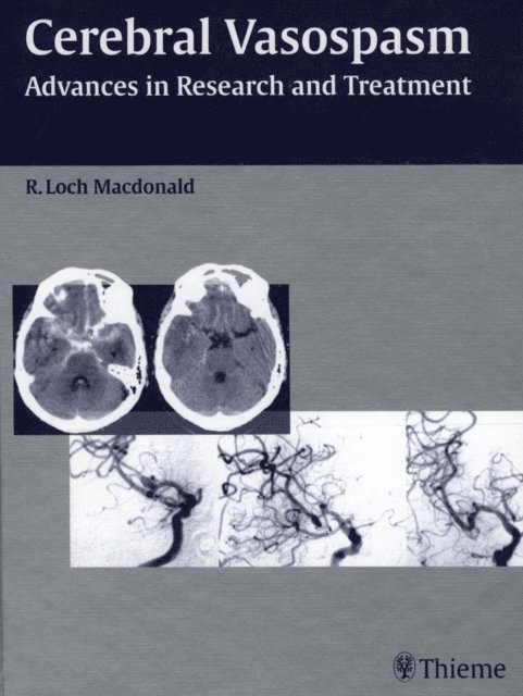 R. Loch Macdonald - Cerebral Vasospasm, E-bok
