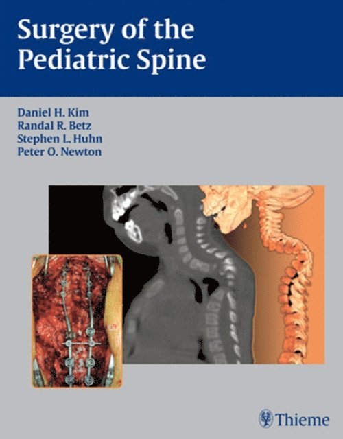 Peter O. Newton, Stephen L Huhn, Randal R. Betz, Daniel H. Kim - Surgery of the Pediatric Spine, E-bok