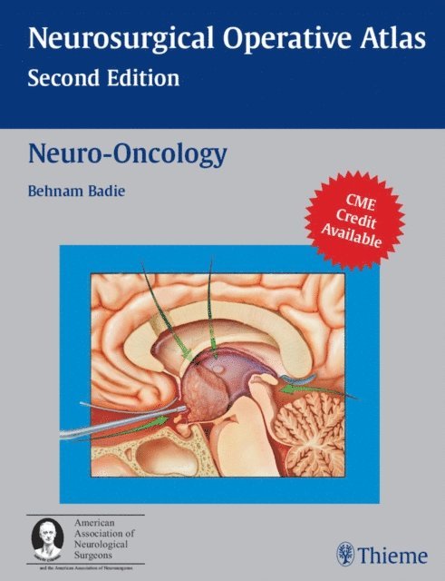Behnam Badie - Neuro-Oncology, E-bok