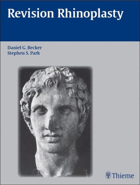 Stephen S. Park, Daniel G. Becker - Revision Rhinoplasty, E-bok