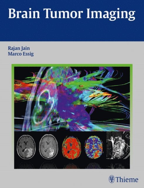 Marco Essig, Rajan Jain - Brain Tumor Imaging, E-bok. Tillgänglighet: Lägg i varukorg