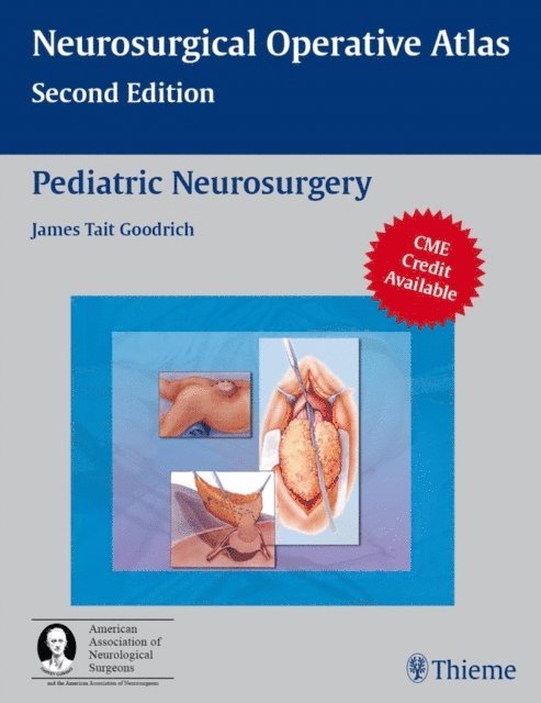 James Tait Goodrich - Pediatric Neurosurgery, E-bok