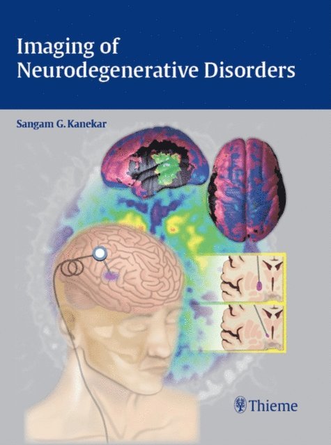 Sangam Kanekar - Imaging of Neurodegenerative Disorders, E-bok