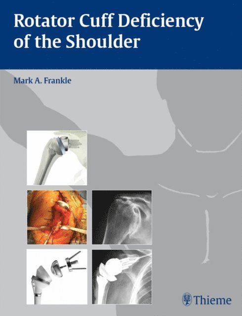 Mark Frankle - Rotator Cuff Deficiency of the Shoulder, E-bok