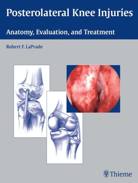 Robert F. LaPrade - Posterolateral Knee Injuries, E-bok