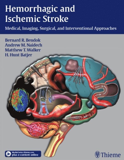 H. Hunt Batjer, Matthew T Walker, Andrew M. Naidech, Bernard R Bendok - Hemorrhagic and Ischemic Stroke, E-bok