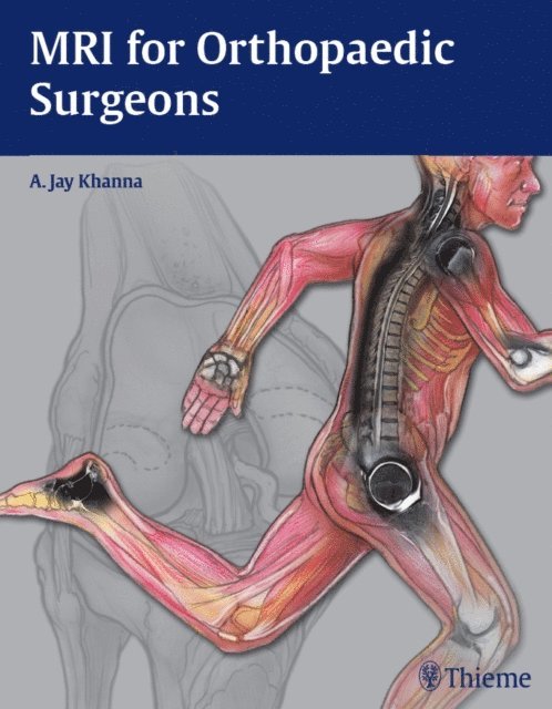 A. Jay Khanna - MRI for Orthopaedic Surgeons, E-bok. Tillgänglighet: Lägg i varukorg