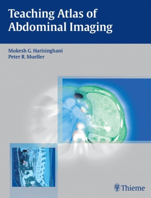 Peter R. Mueller, Mukesh G. Harisinghani - Teaching Atlas of Abdominal Imaging, E-bok