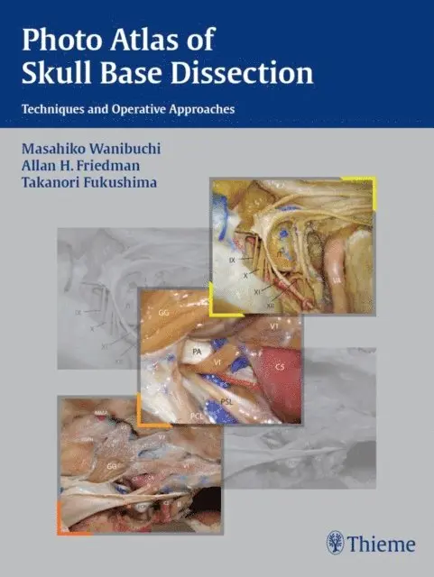 Takanori Fukushima, Allan H. Friedman, Masahiko Wanibuchi - Photo Atlas of Skull Base Dissection, E-bok. Tillgänglighet: Lägg i varukorg