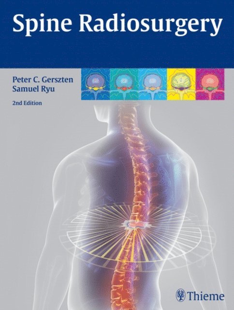 Samuel Ryu, Peter Gerszten - Spine Radiosurgery, E-bok