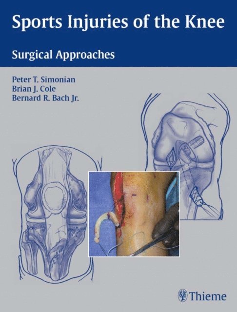 Bernard R. Bach, Brian J. Cole, Peter T. Simonian - Sports Injuries of the Knee, E-bok