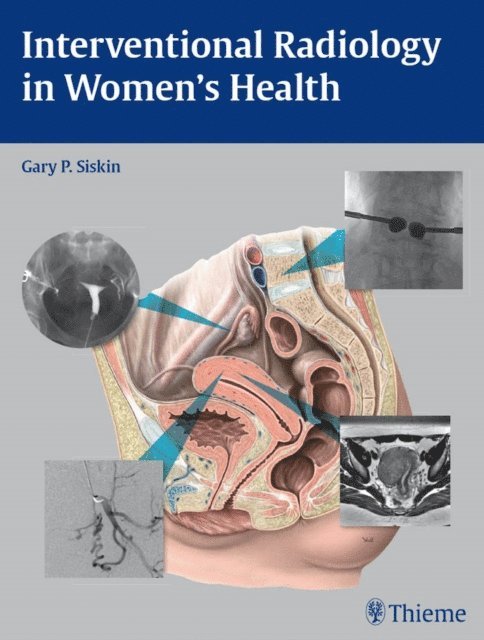 Gary P. Siskin - Interventional Radiology in Women's Health, E-bok
