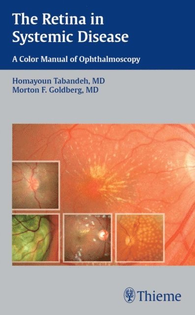 Morton F. Goldberg, Homayoun Tabandeh - Retina in Systemic Disease, E-bok. Tillgänglighet: Lägg i varukorg