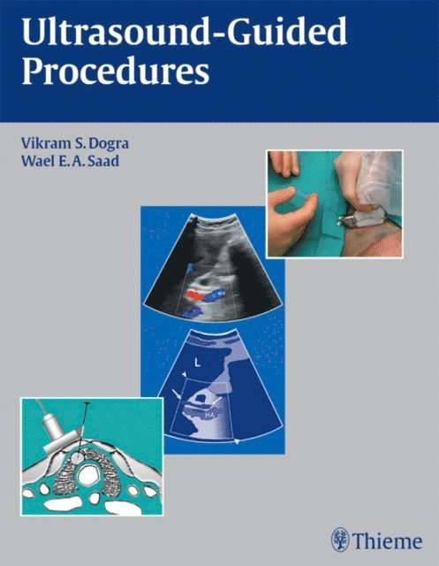 Wael E. A. Saad, Vikram S. Dogra - Ultrasound-Guided Procedures, E-bok