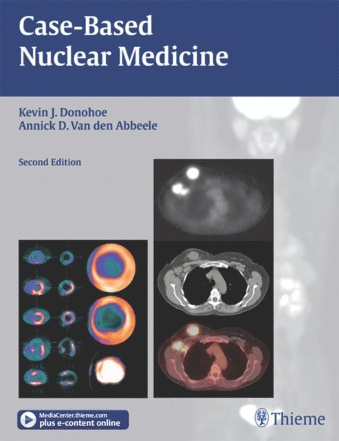 Annick D. Van den Abbeele, Kevin J. Donohoe - Case-Based Nuclear Medicine, E-bok. Tillgänglighet: Lägg i varukorg