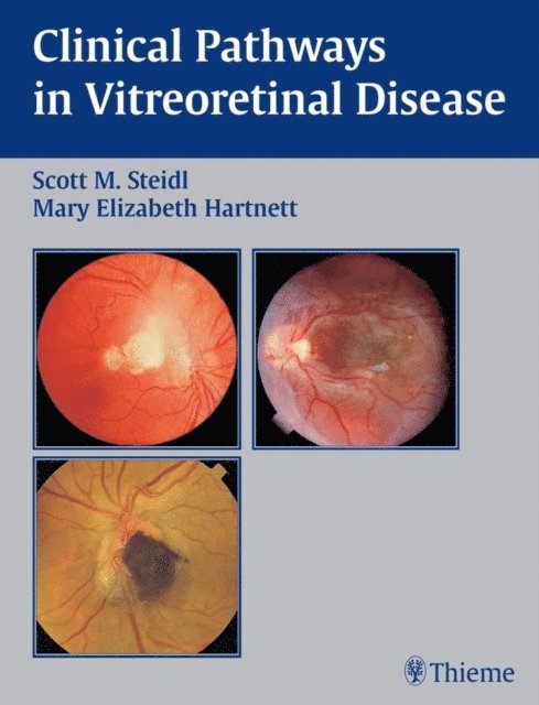 Mary Elizabeth Hartnett, Scott M. Steidl - Clinical Pathways In Vitreoretinal Disease, E-bok