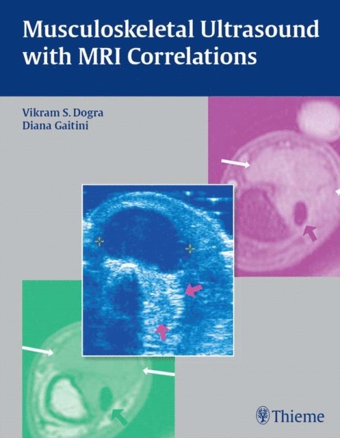 Diana Gaitini, Vikram S. Dogra - Musculoskeletal Ultrasound with MRI Correlations, E-bok